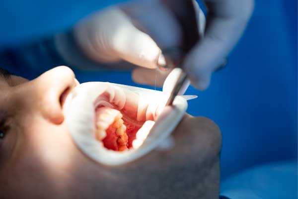 Tratamiento dental, emergencias dentales